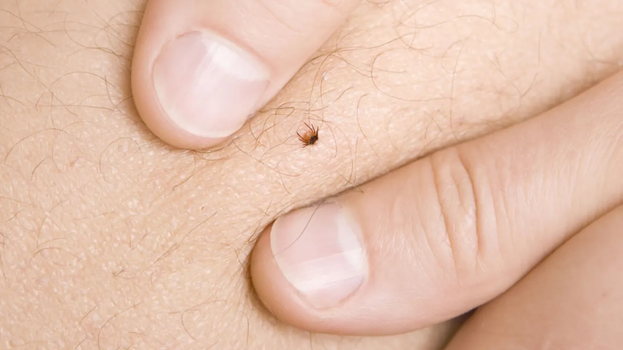 Jak prawidłowo usunąć kleszcza