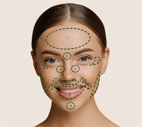 botox czoło schemat dawkowania