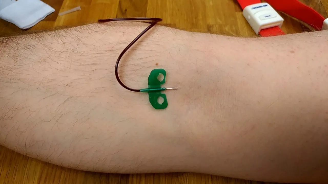 Zdjęcie Jak podłączyć kroplówkę do wenflonu bez ryzyka komplikacji?