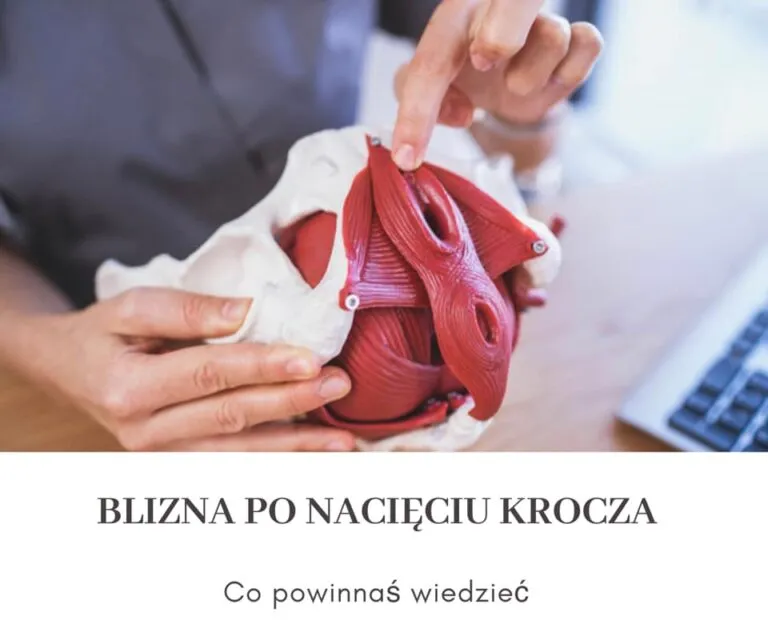 Zdjęcie Jak długo boli krocze po porodzie? Czas gojenia i łagodzenie bólu