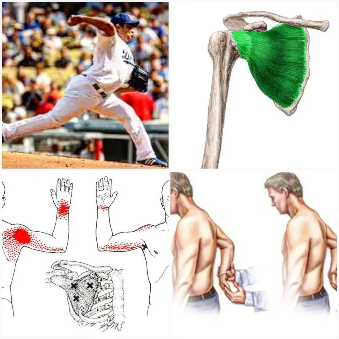 Zdjęcie Todo sobre el músculo subescapular: anatomía, funciones y lesiones