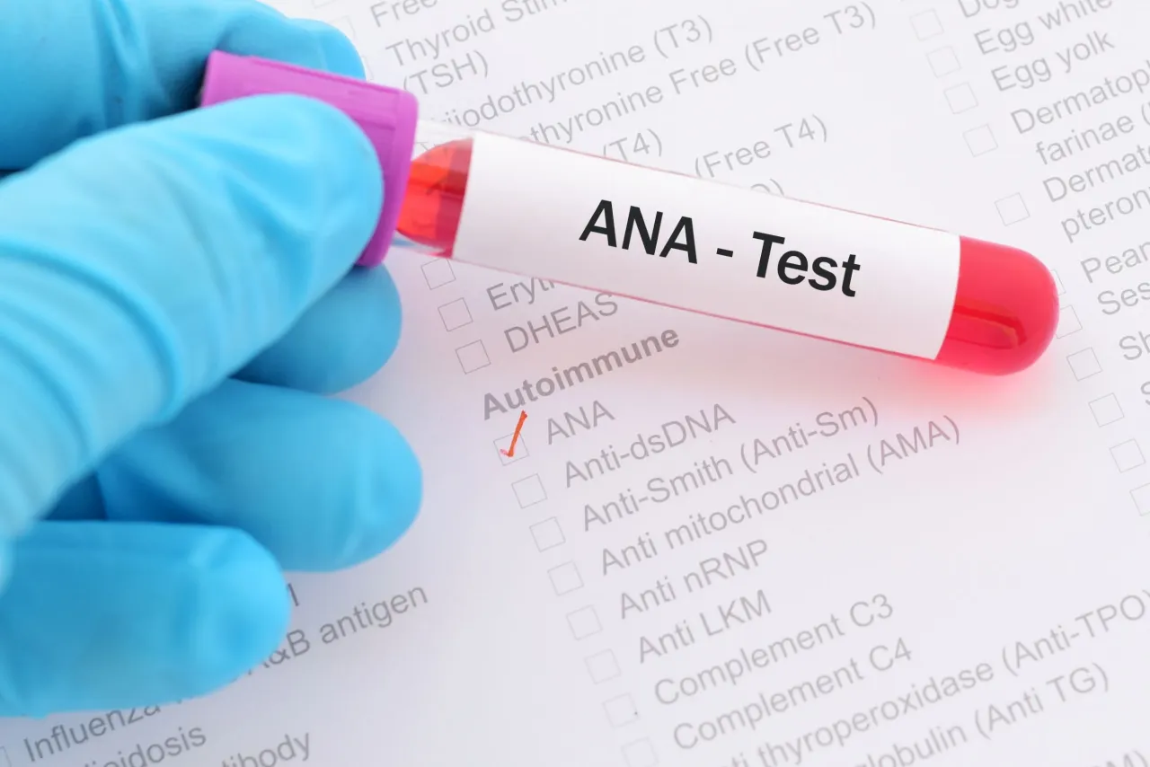 Zdjęcie Badanie ANA1 – co to jest i jak może pomóc w diagnostyce chorób autoimmunologicznych
