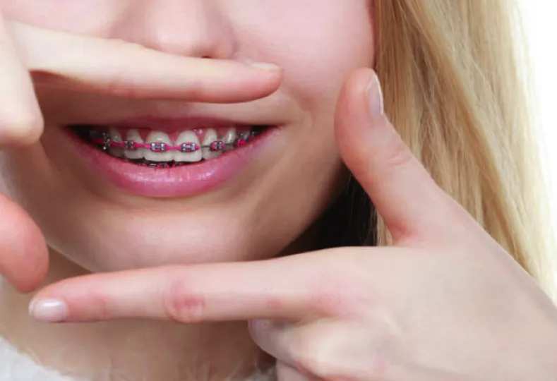 aparat ruchomy dla dzieci w ustach zdjęcie