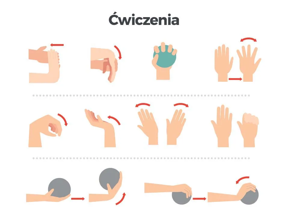 prawidłowe ułożenie ręki po operacji cieśni nadgarstka, ćwiczenia palców po operacji nadgarstka