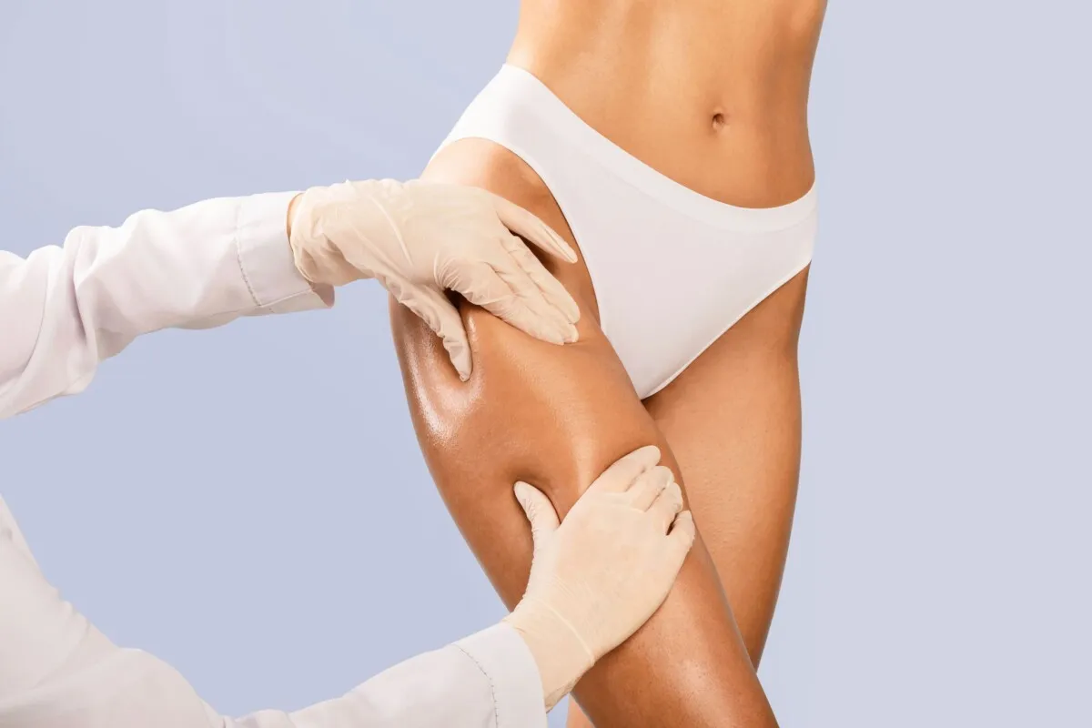 Dłonie w rękawiczkach badają udo, sugerując metody jak pozbyć się cellulitu w tydzień.