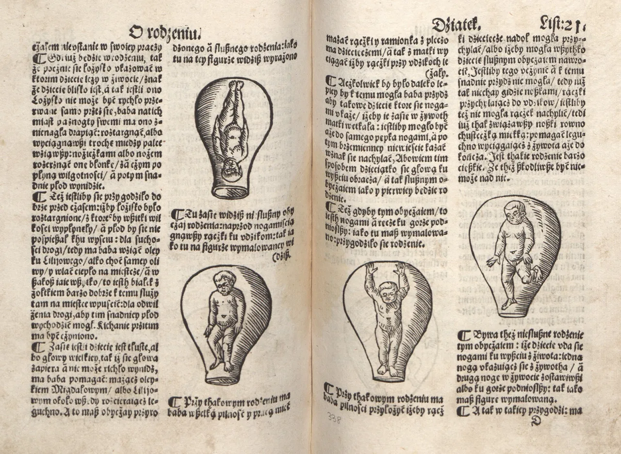 Średniowieczne amulety porodowe zabobony