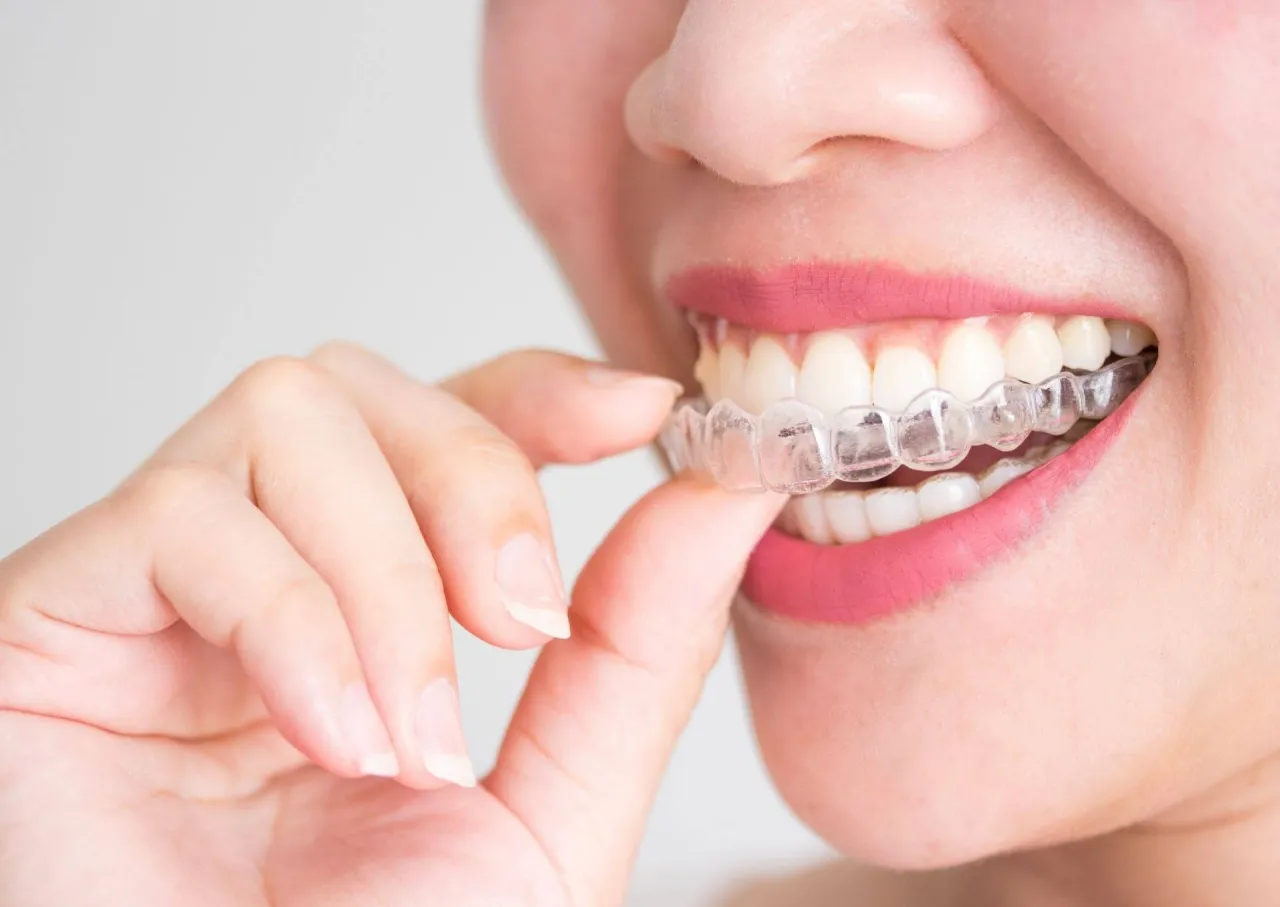 aparat ortodontyczny na zęby