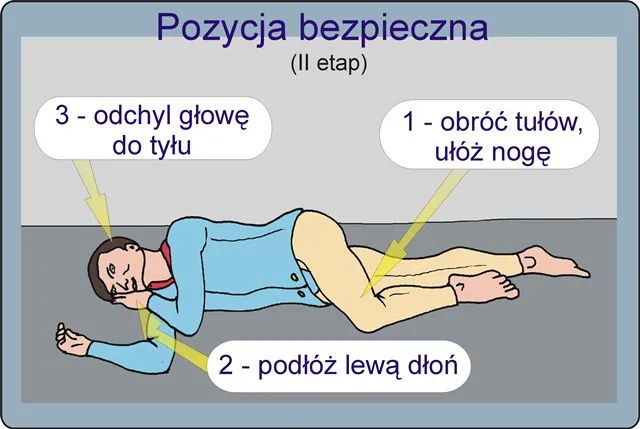 Zdjęcie Jak wygląda pozycja bezpieczna, aby uratować życie poszkodowanego