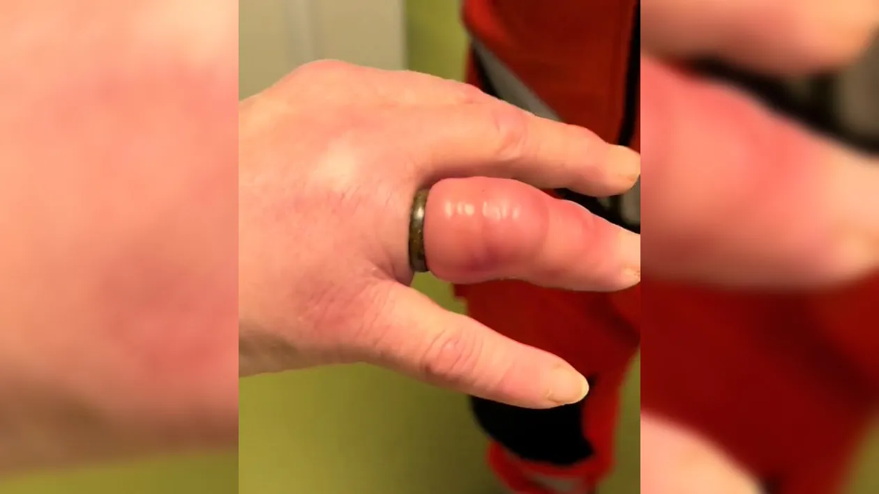 siny palec obrączka alarm