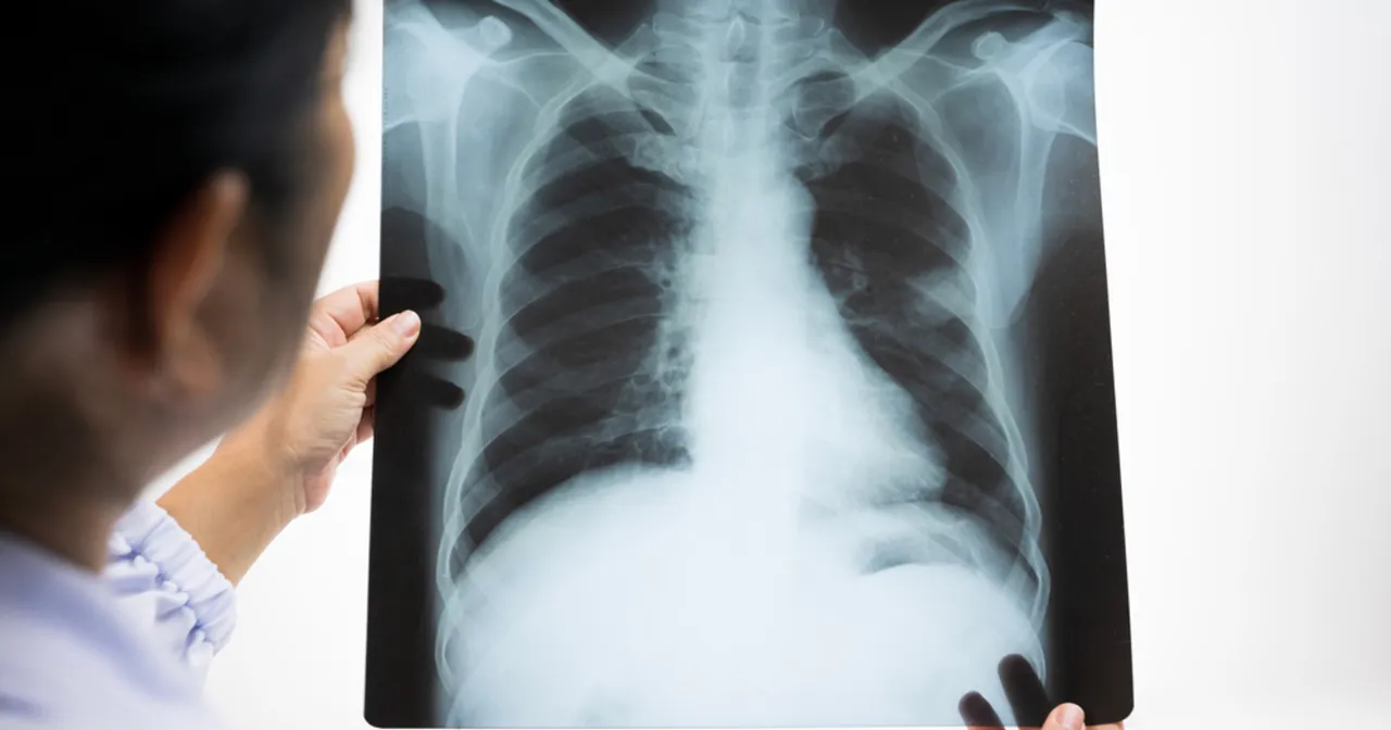 Pacjent onkologiczny, nadzieja, złożoność leczenia raka