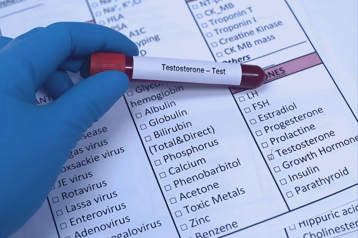 Przygotowanie do badania krwi testosteron