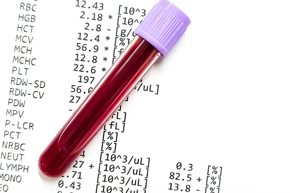 Probówka z krwią na tle wyników badań. Różne normy laboratoryjne mogą wynikać z metod pomiarowych i populacji badanych.
