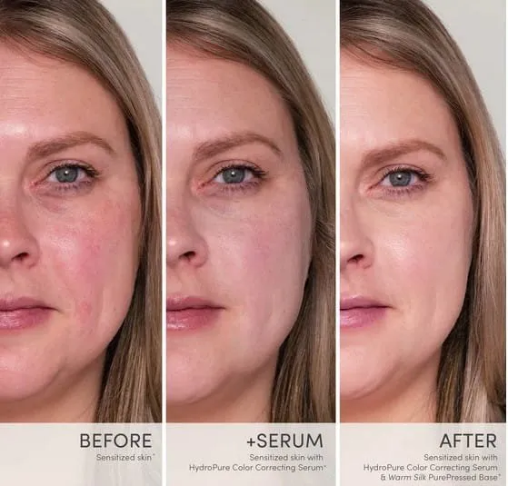 skóra twarzy przed i po poprawie kolorytu