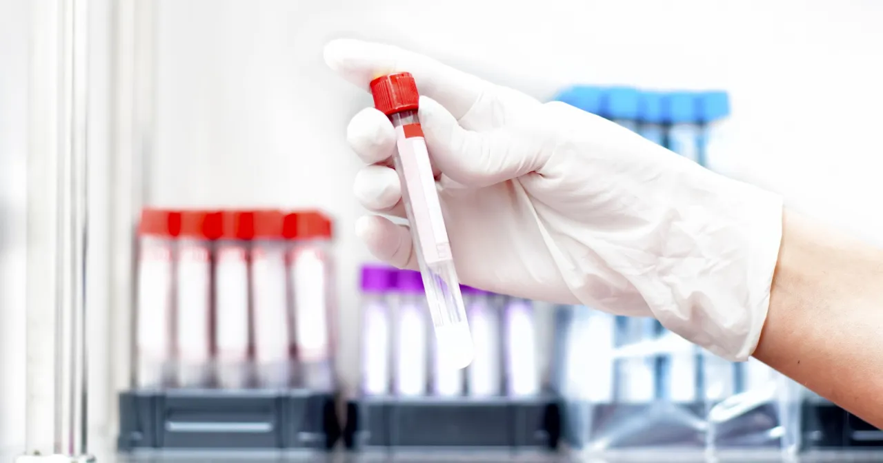 Ręka w białej rękawiczce trzyma prob&oacute;wkę z krwią, gotową do badań, np. jakie badanie krwi na pasożyty.