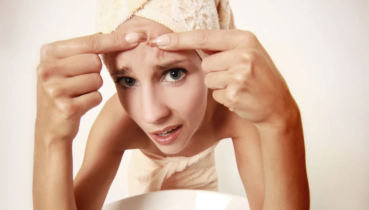 Nie wyciskaj pryszczy