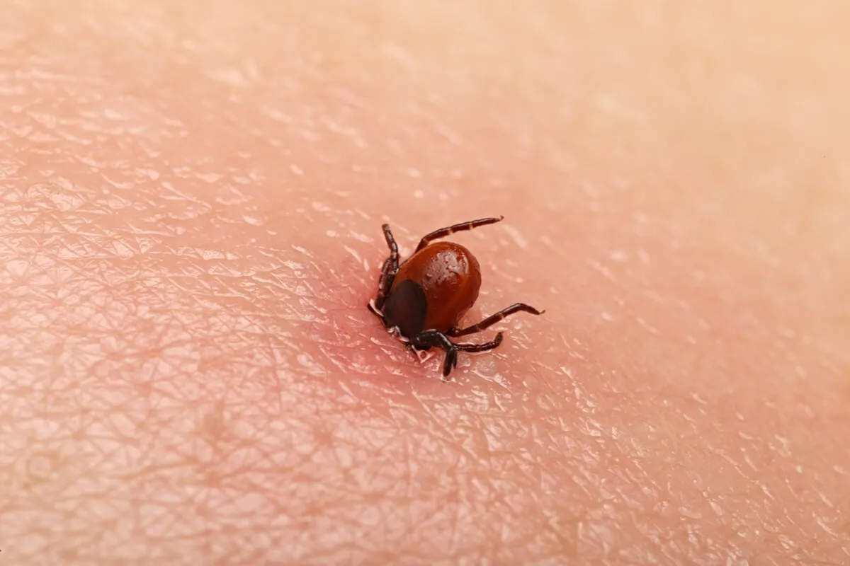 Zdjęcie Jakie choroby przenosi kleszcz i jak ich unikać, by się nie zarazić