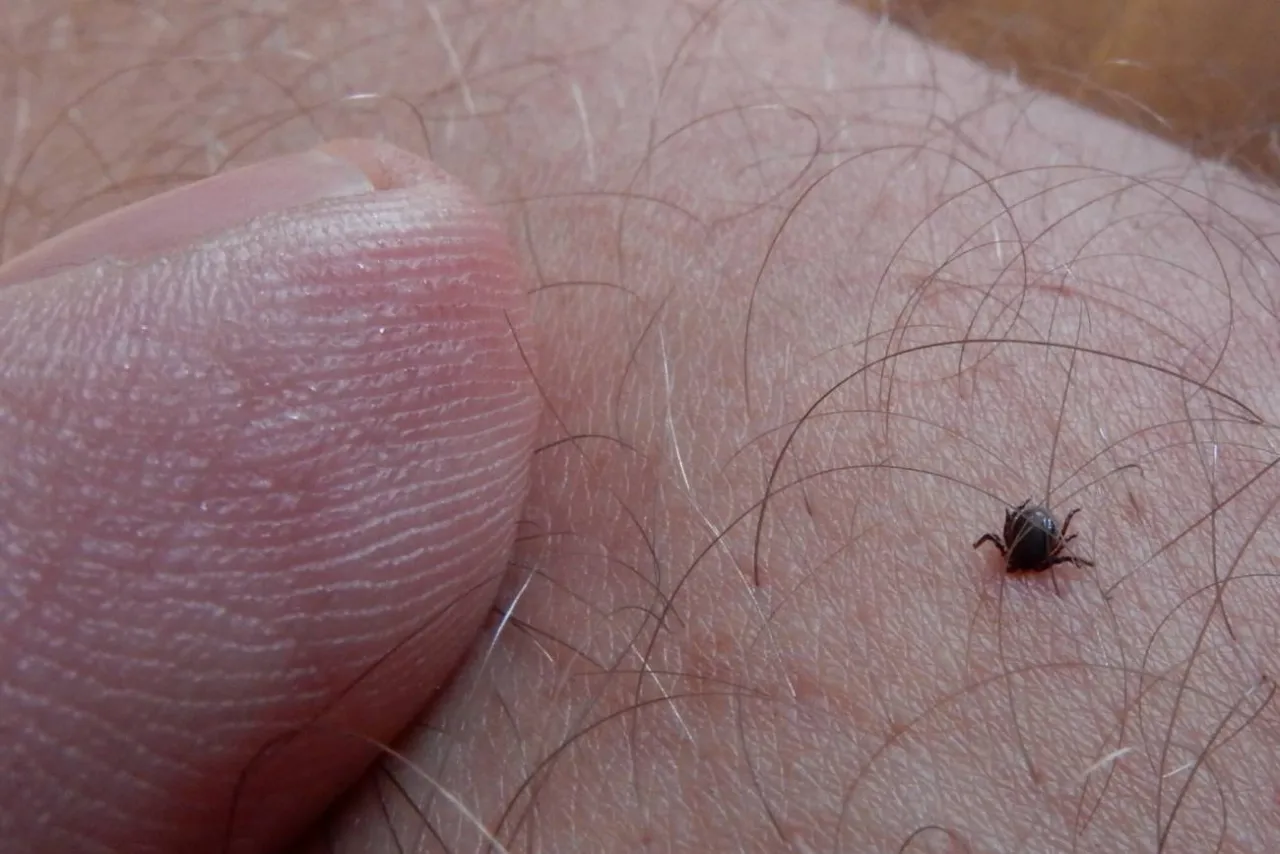 niegroźny odczyn po ugryzieniu kleszcza