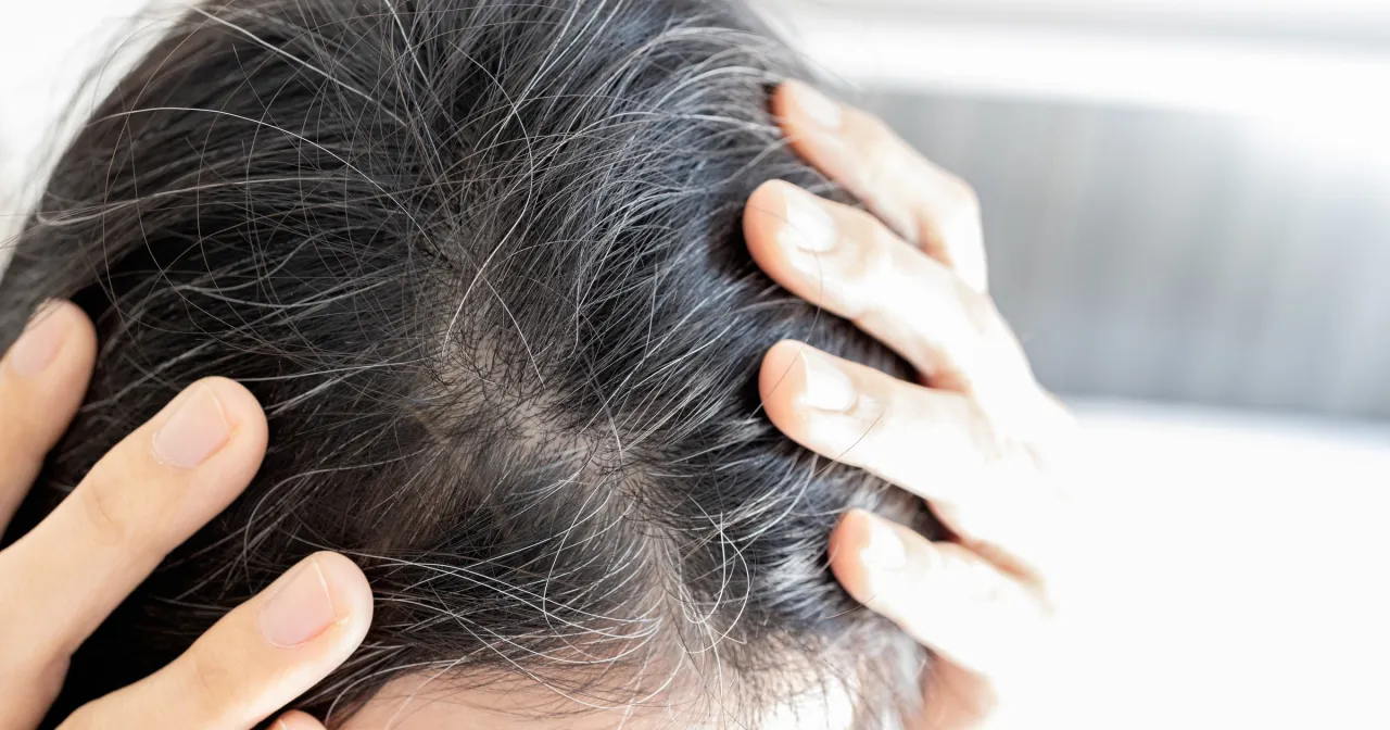 przyczyny braku kwasu foliowego