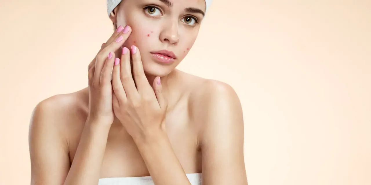 Młoda kobieta z pryszczami na twarzy, dotykająca policzka. Szuka rozwiązania, co na pryszcze na twarzy.