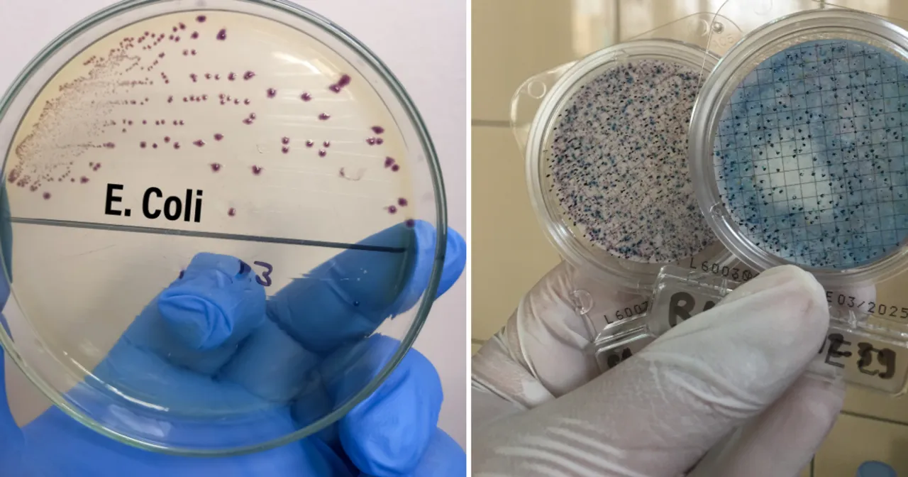 Bakterie E. coli i Salmonella pod mikroskopem