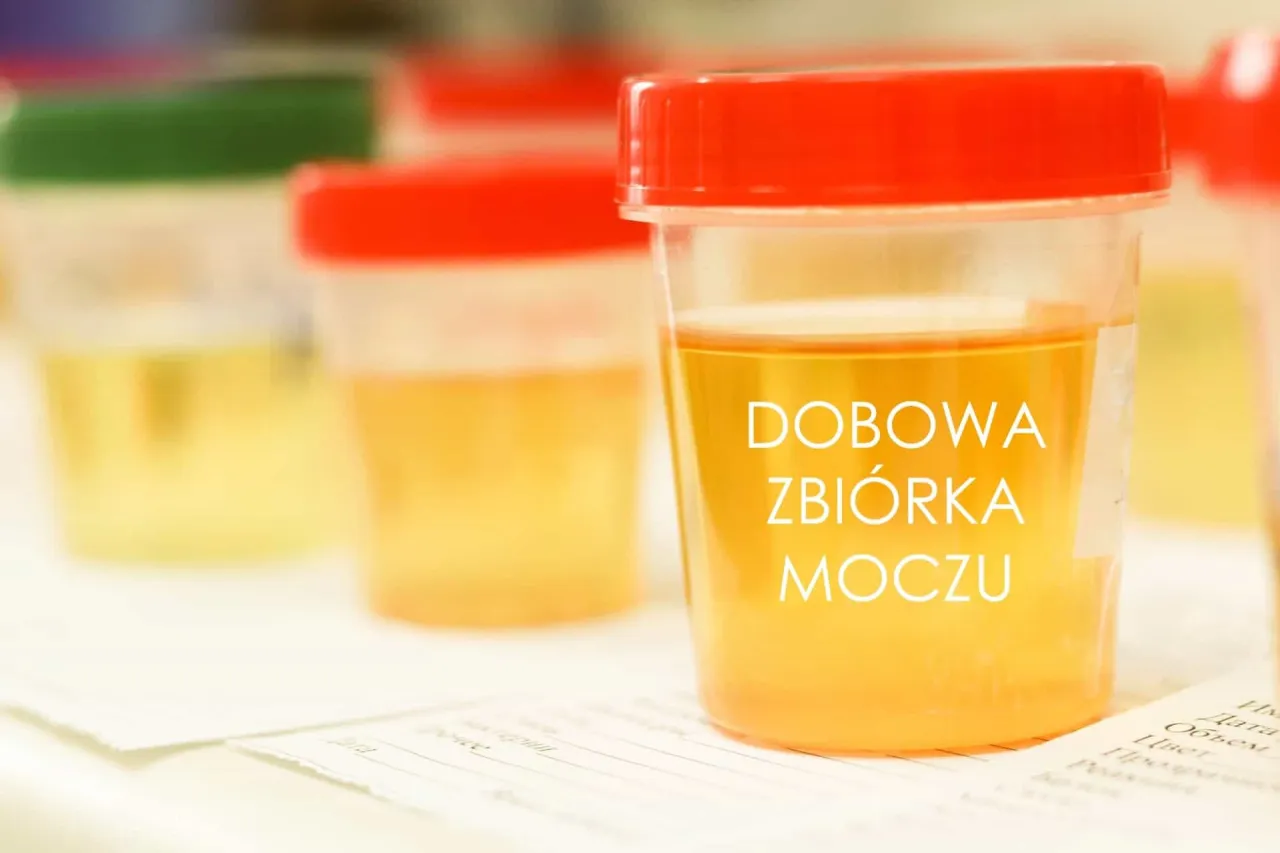 zestaw do badania moczu dobowa zbi&oacute;rka