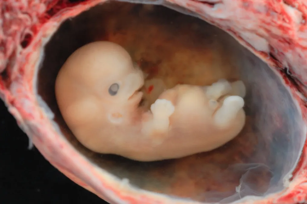 dziecko 8 tydzień życia