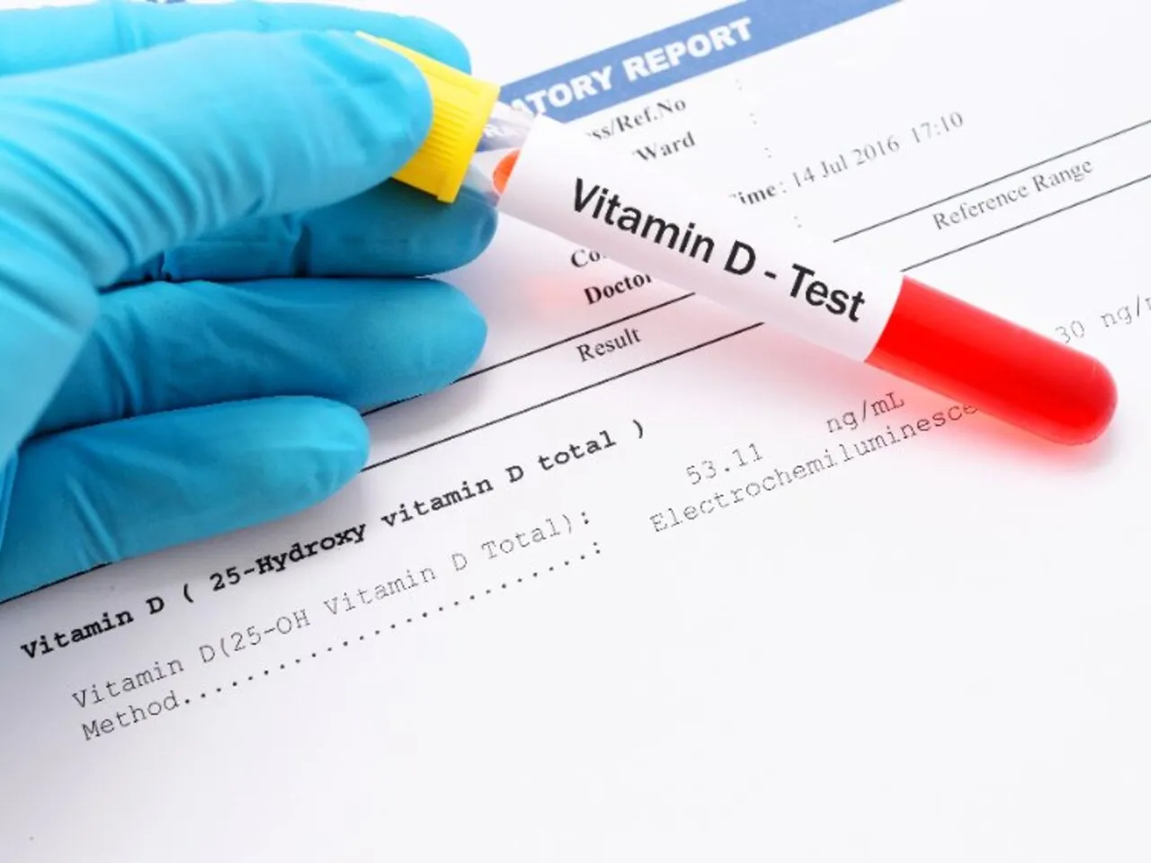 Badanie poziomu witaminy D we krwi