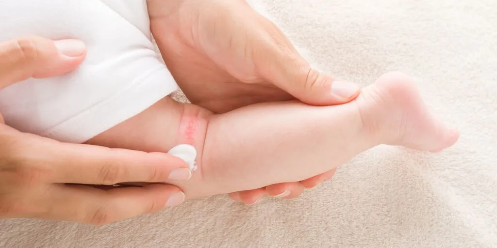 Objawy gronkowca u dziecka na skórze