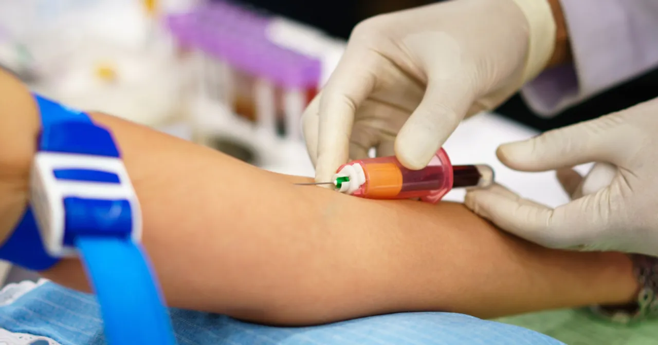 Podstawowe badania krwi udar