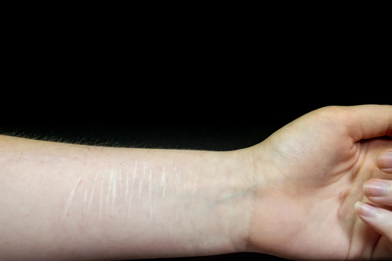 impulsywne zachowania, samookaleczenia, radzenie sobie z emocjami