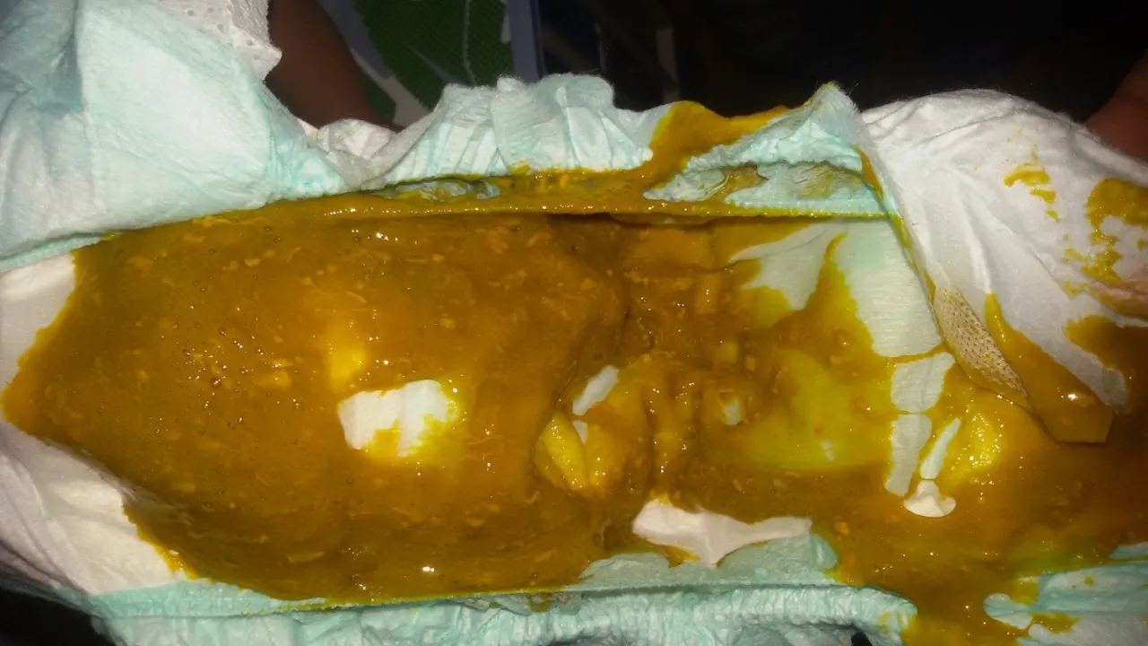 normalne kupki niemowlaka rozszerzona dieta kolory konsystencje