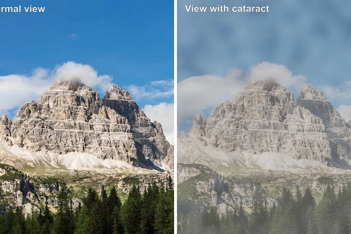 Objawy zaćmy porównanie widzenia zdrowego i z zaćmą