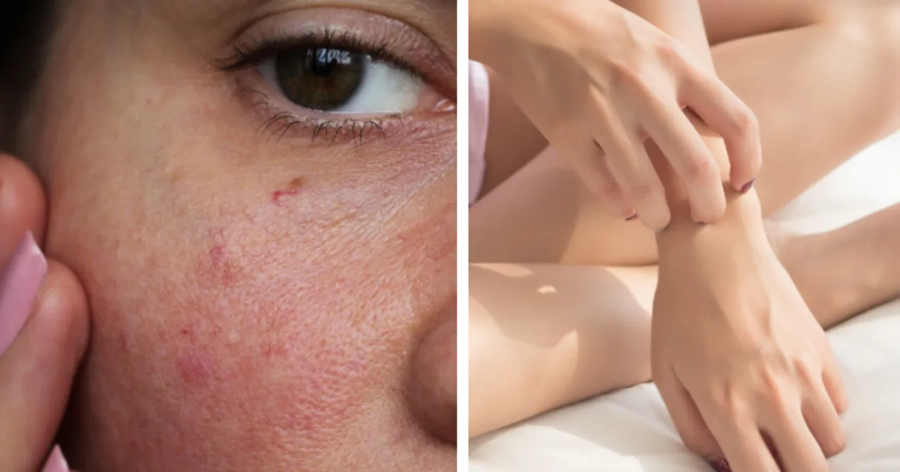 suplementy witamina D niedobory