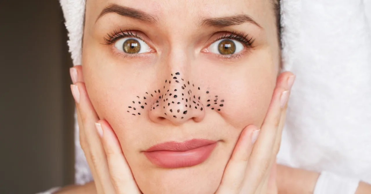 Pielęgnacja cery trądzikowej