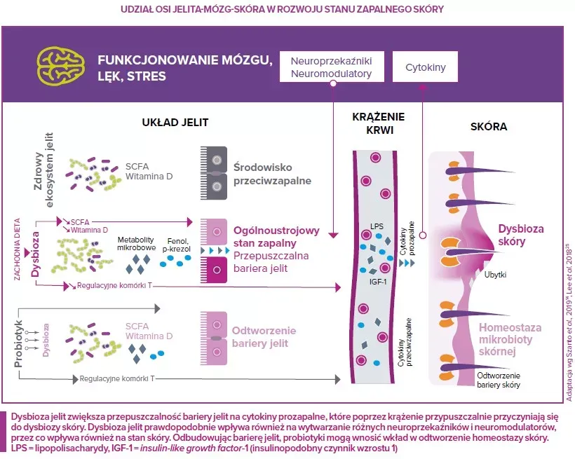 infografika oś jelito mózg