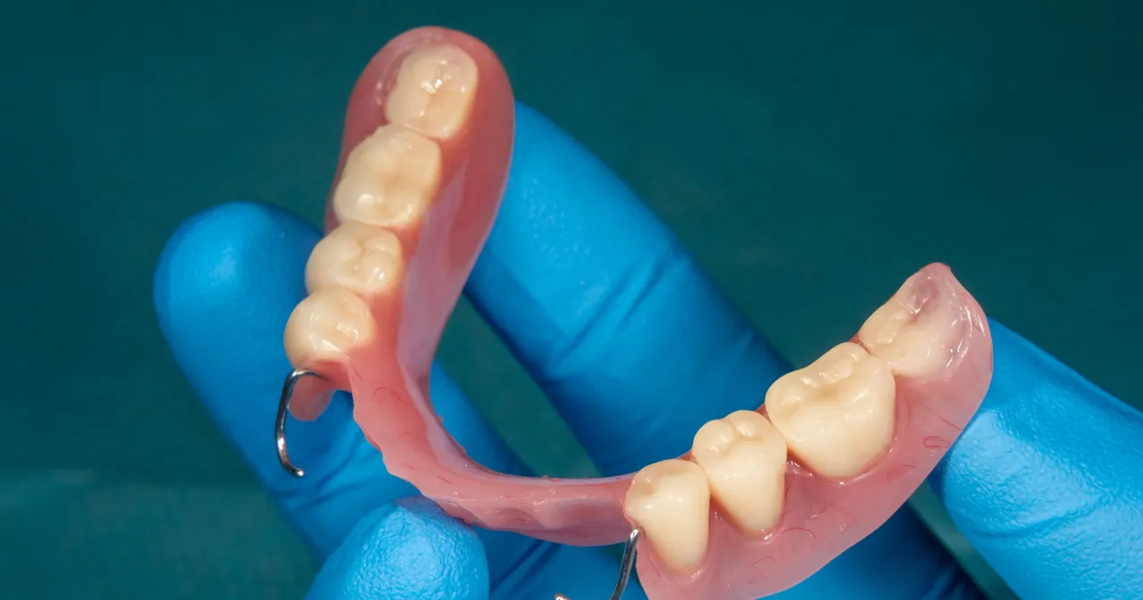 Proteza zębowa na NFZ? Zapytaj swojego dentystę, gdzie zrobić protezę zębową na NFZ. Dentyści pomogą Ci odzyskać uśmiech.