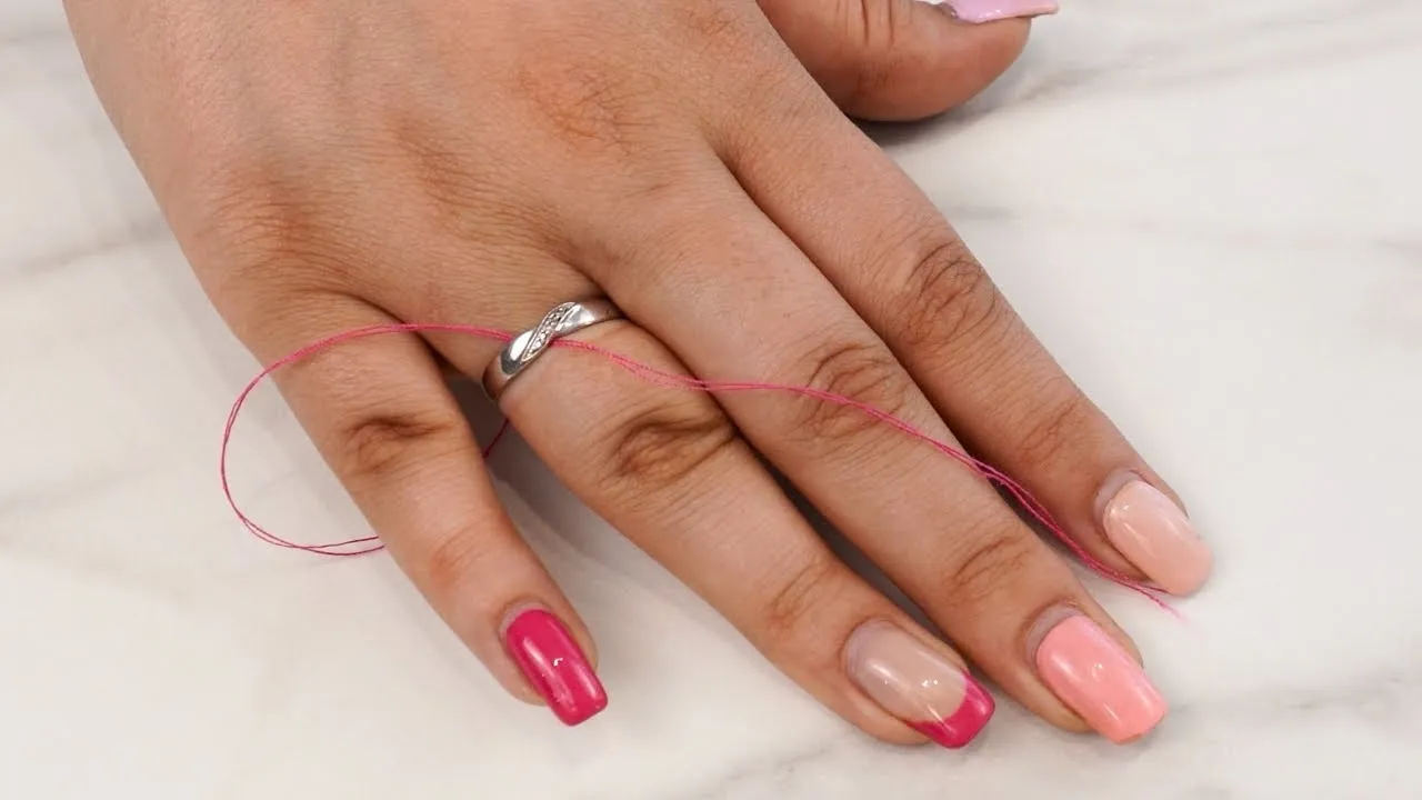 metoda nitkowa zdejmowanie obrączki