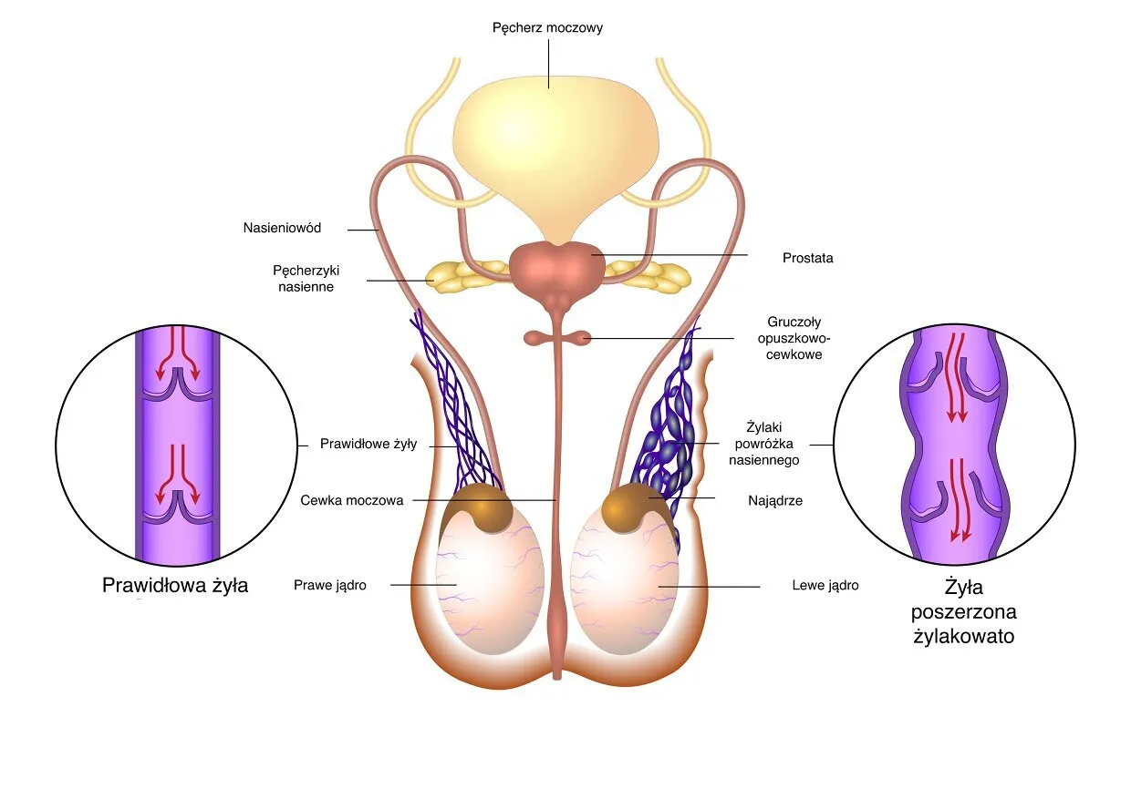objawy skrętu jądra kontra b&oacute;l po stymulantach