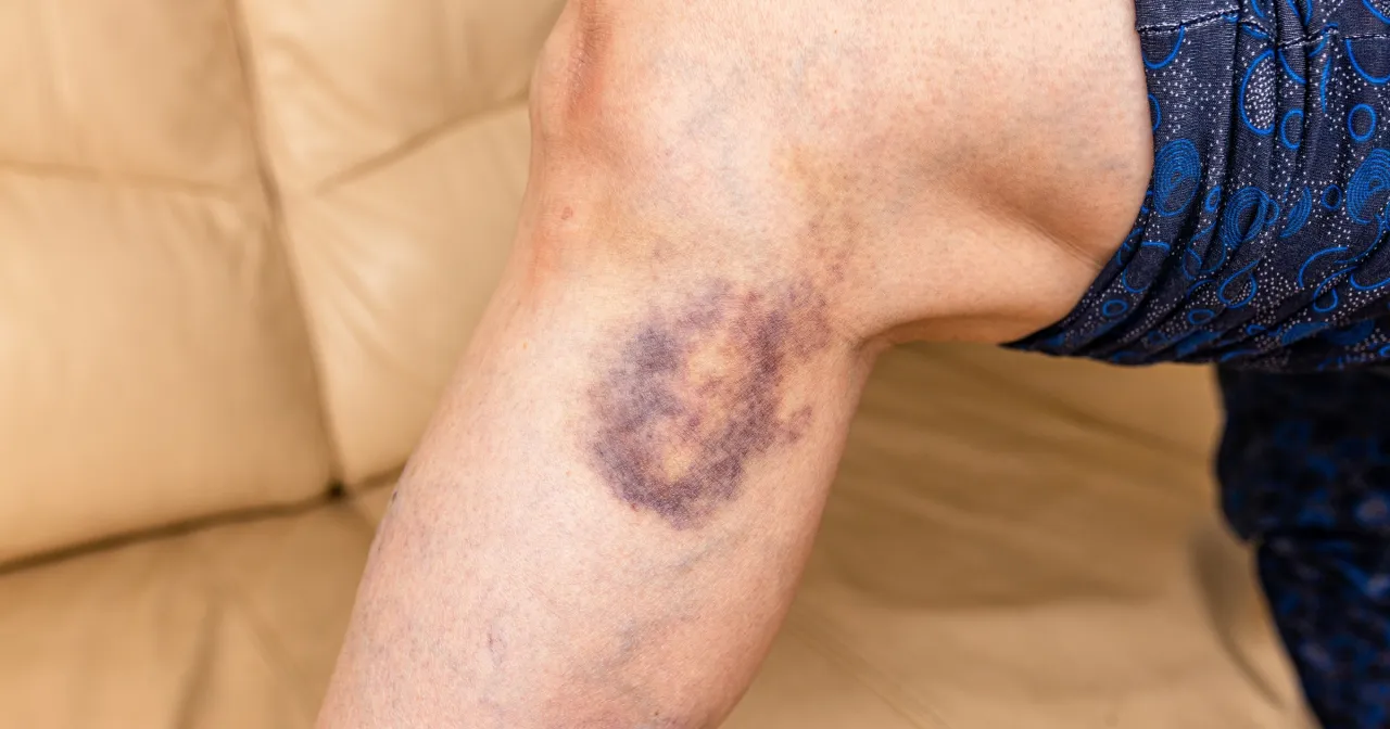 niepokojące objawy chorób krwi