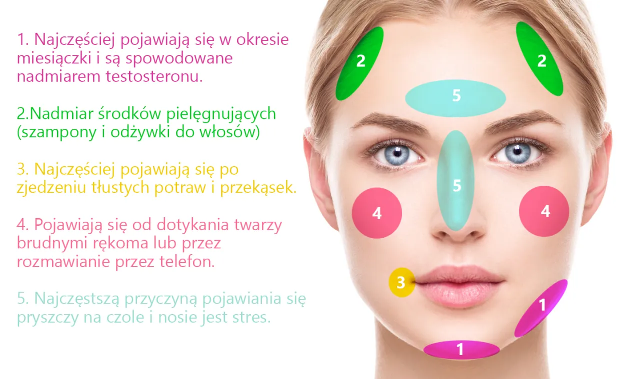 przyczyny pryszczy na czole infografika