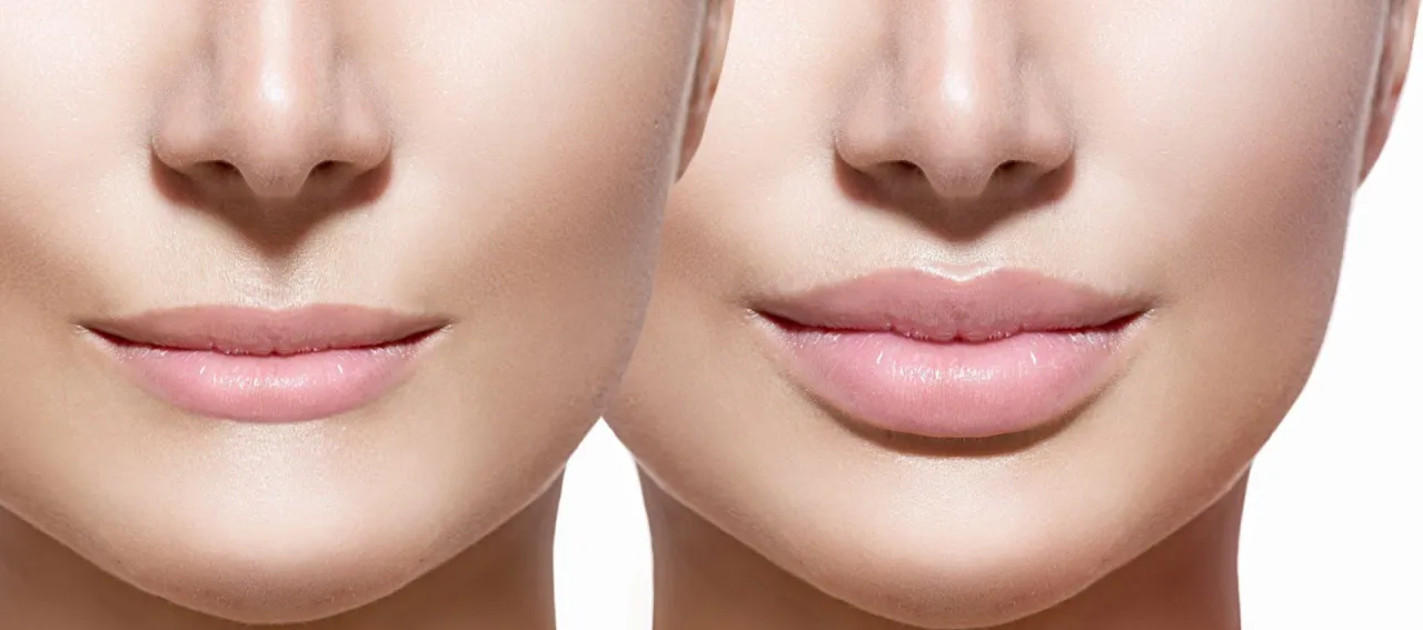 powiększanie ust gabinet medycyny estetycznej