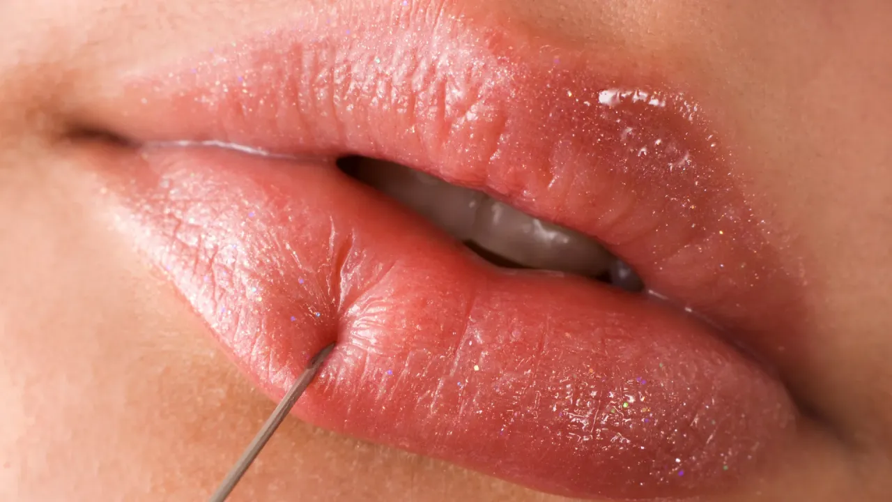 Metody znieczulenia powiększanie ust