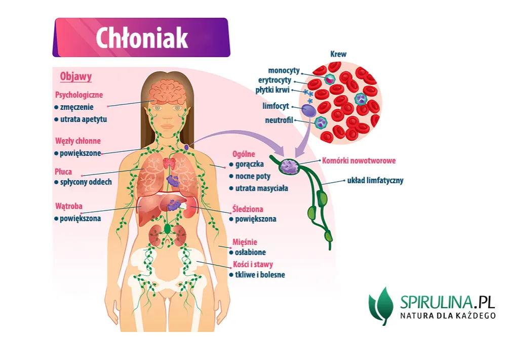Zdjęcie Czy badanie krwi wykryje chłoniaka? Kluczowe informacje o diagnostyce