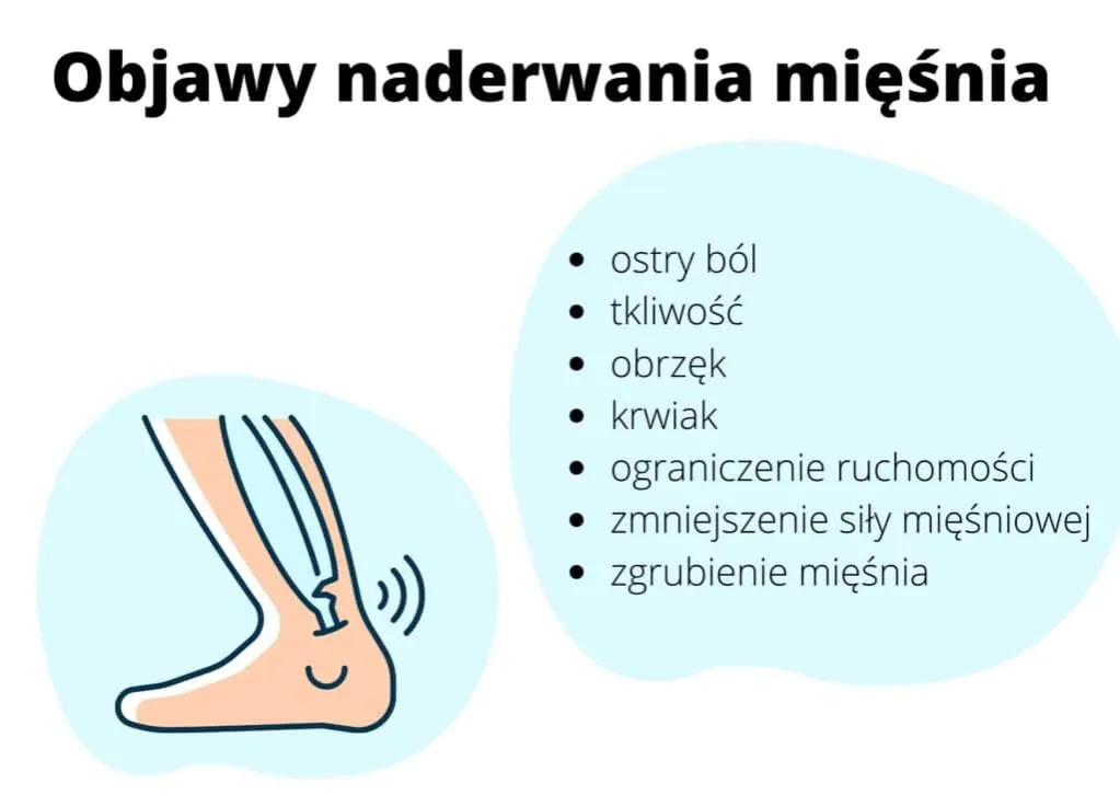 Zdjęcie Naderwany mięsień jaki lekarz - jak uniknąć błędnych wyborów medycznych