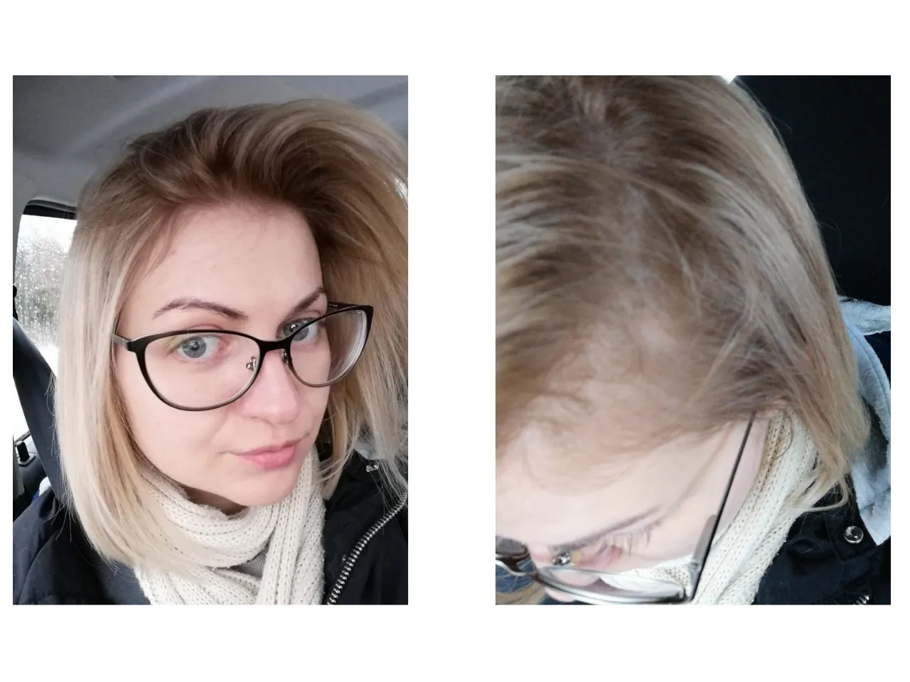 Zdjęcie Jak skutecznie zatuszować ciemny odrost przy blondzie bez amoniaku