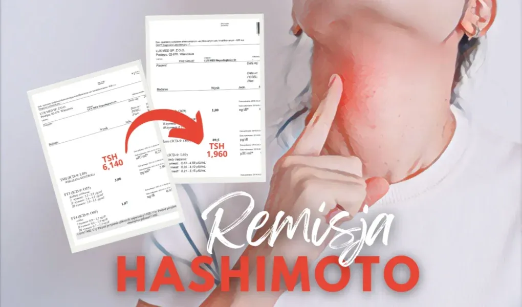 Zdjęcie Czy choroba Hashimoto kwalifikuje do renty? Sprawdź kryteria i proces