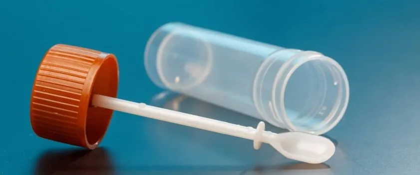 Zdjęcie Badanie kału – ile wcześniej można pobrać próbkę, aby uniknąć błędów?