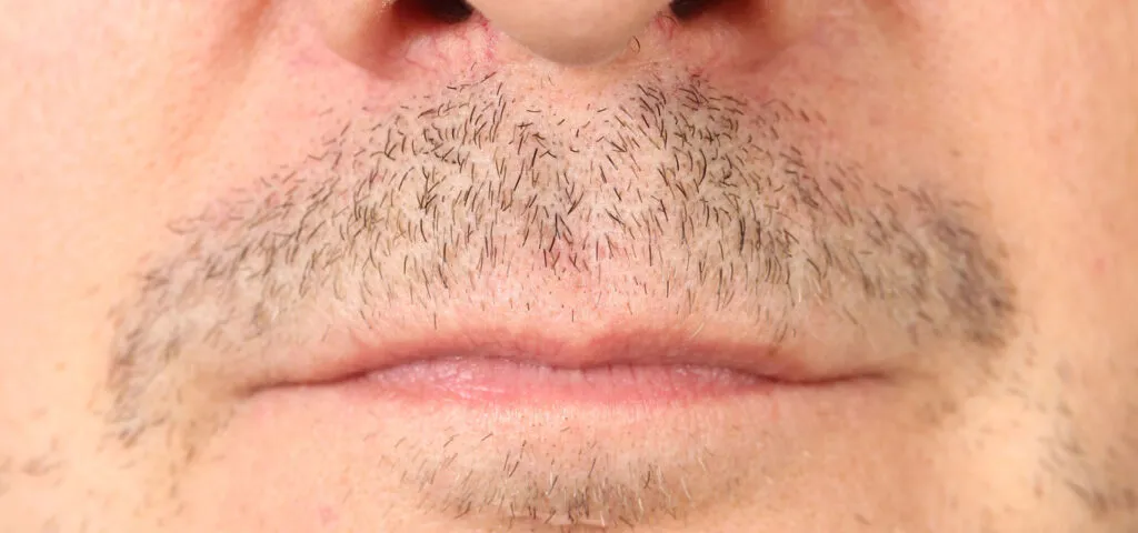 Zdjęcie Jak pobudzić zarost? Od domowych sposob&oacute;w do minoksydylu