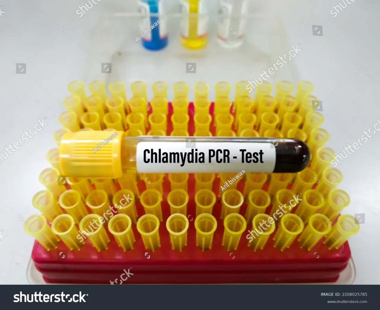 Zdjęcie Badanie PCR na chlamydię – jak wygląda, przygotowanie i co warto wiedzieć