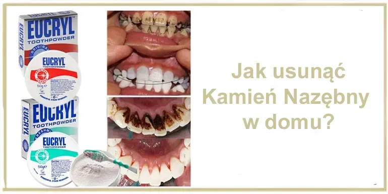 uszkodzone szkliwo domowe sposoby na kamień